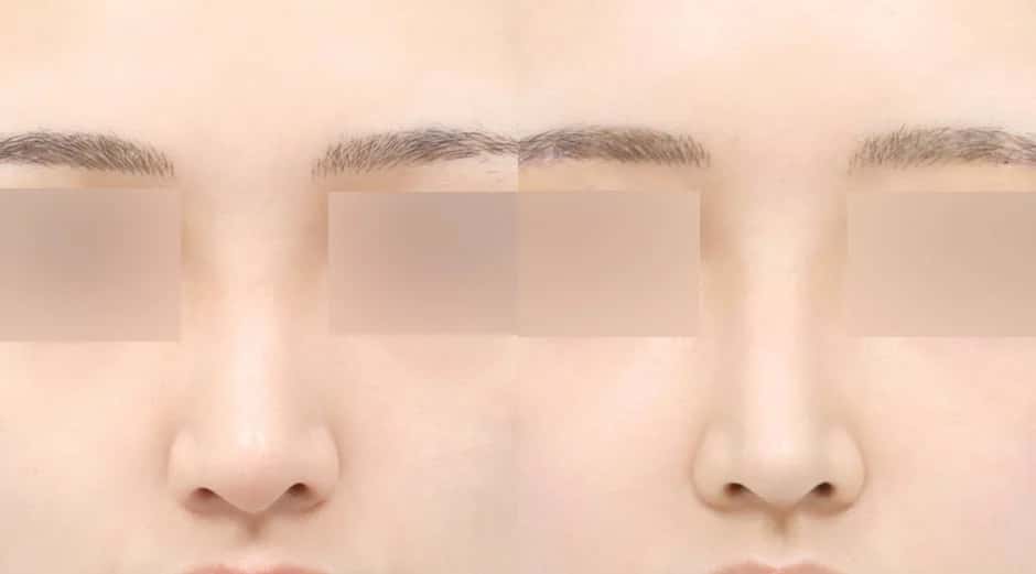 bannerImage