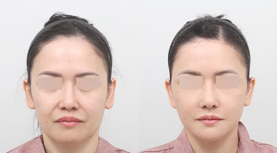 AB Plastic Surgery