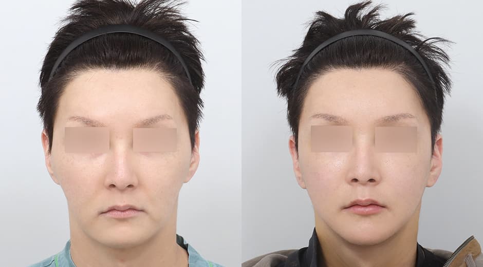 AB Plastic Surgery