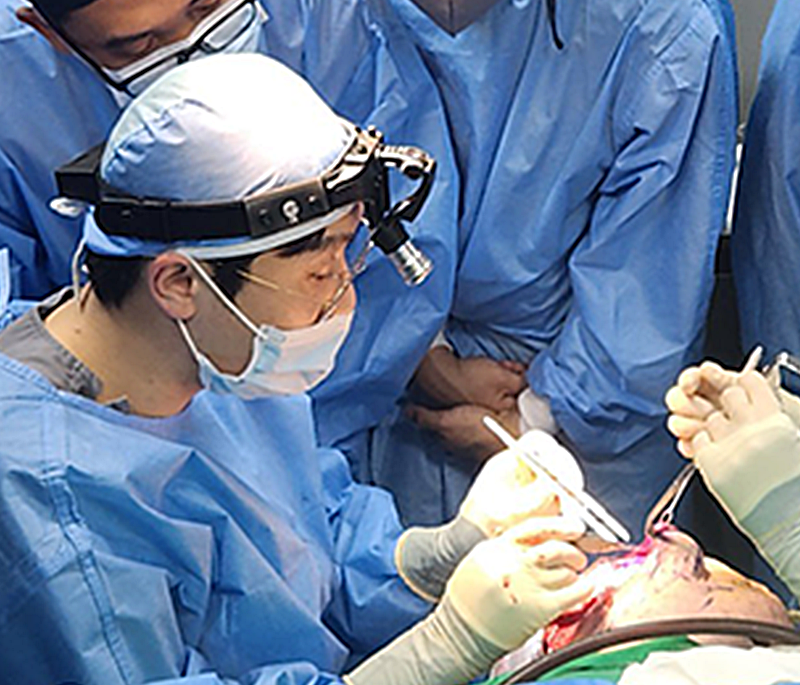 Facelift dissection technique point 3: With meticulous dissection techniques, achieve a smooth facial contour without any unevenness.