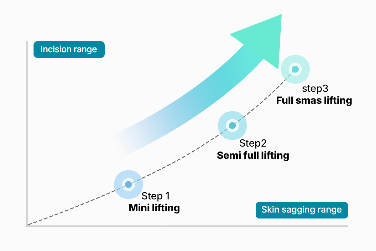 Customized three-stage facelift tension graph