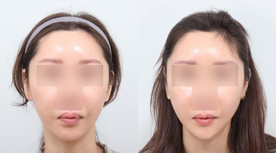 AB Plastic Surgery