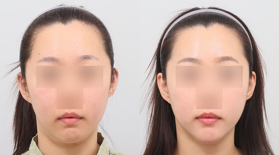 AB Plastic Surgery