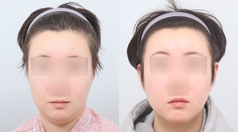 AB Plastic Surgery