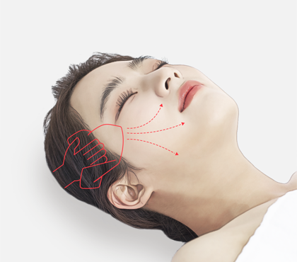 Anti Aging Thread Lift image