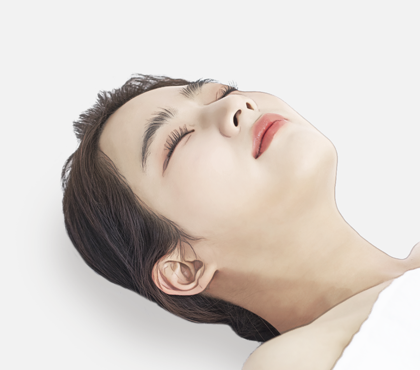 Anti Aging Thread Lift image
