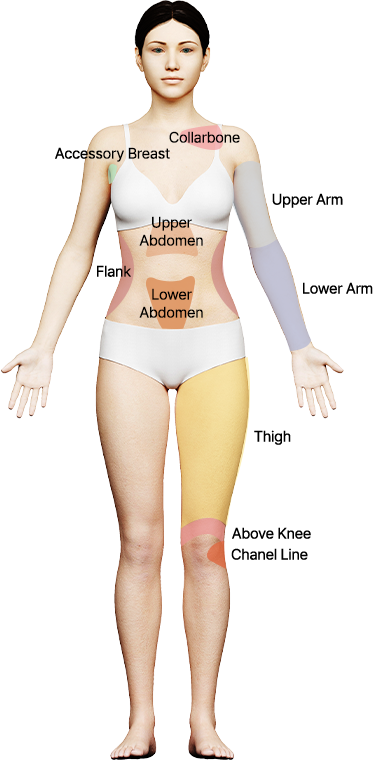 Front view liposuction surgical areas diagram