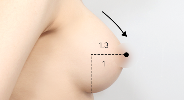 Breast Mento Breast Implants Surgery Point image