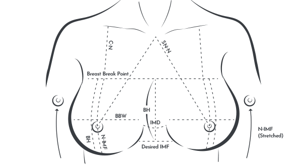 Breast Mento Breast Implants Surgery Point image