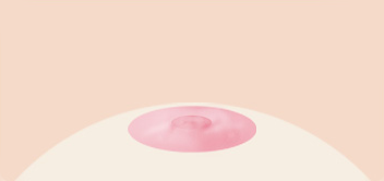 Breast Nipple Surgery image