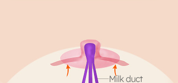 Breast Nipple Surgery image
