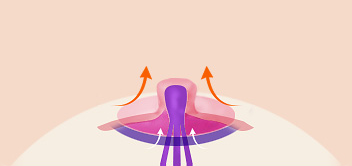 Breast Nipple Surgery image