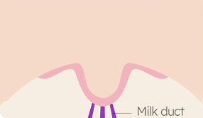 Breast Nipple Surgery image