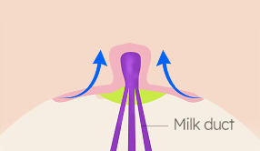 Breast Nipple Surgery image