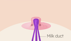 Breast Nipple Surgery image