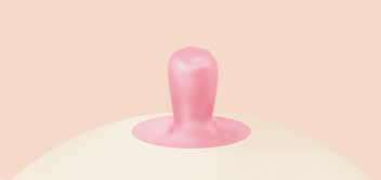 Breast Nipple Surgery image