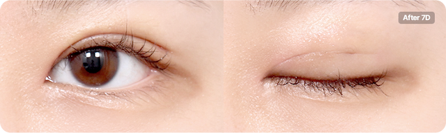 beforeAfter