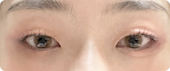 beforeAfter