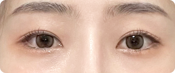 beforeAfter