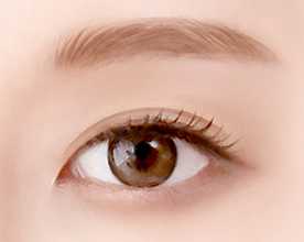 Eye Middle Age Eyelid Upper Blepharoplasty image