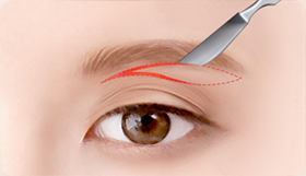 Eye Middle Age Eyelid Natural Adhesion image