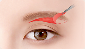 Eye Middle Age Eyelid Natural Adhesion image