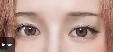 Eye Revision Blepharoplasty Solution Solution Card image