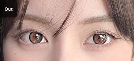 Eye Revision Blepharoplasty Solution Solution Card image