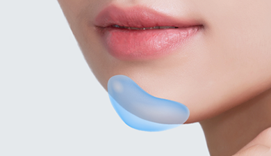 Facial Contouring Facial Implant image