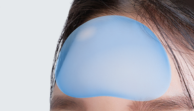 Facial Contouring Facial Implant image