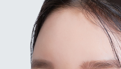 Facial Contouring Facial Implant image