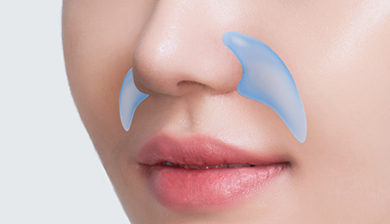 Facial Contouring Facial Implant image
