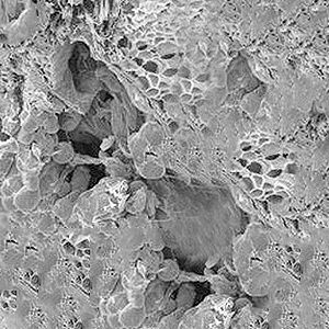 Facial Contouring Soft Tissue Contouring Acculift image