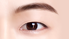 Male Plastic Surgery Male Blepharoplasty image