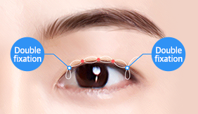 Male Plastic Surgery Male Blepharoplasty image