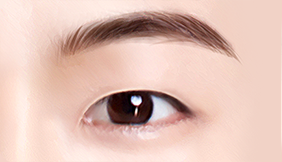 Male Plastic Surgery Male Blepharoplasty image