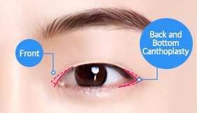 Male Plastic Surgery Male Blepharoplasty image