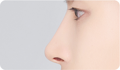 Male Plastic Surgery Male Rhinoplasty image
