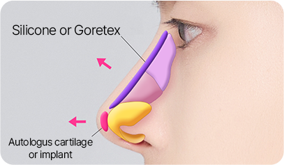 Male Plastic Surgery Male Rhinoplasty image