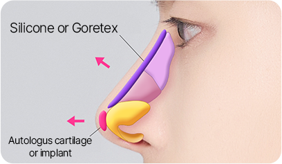 Male Plastic Surgery Male Rhinoplasty image