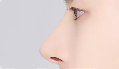 Male Plastic Surgery Male Rhinoplasty image