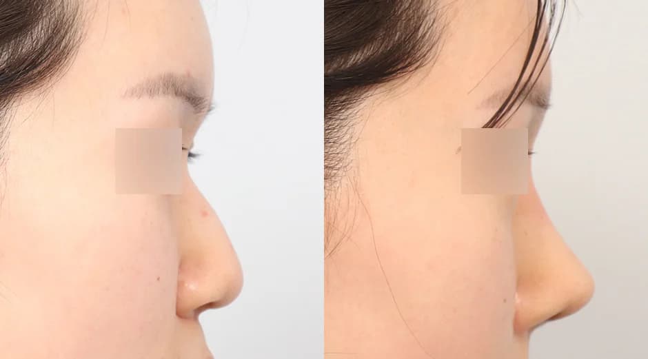 AB Plastic Surgery