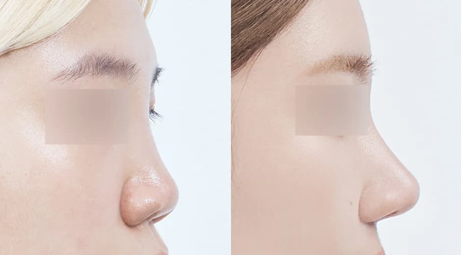 AB Plastic Surgery
