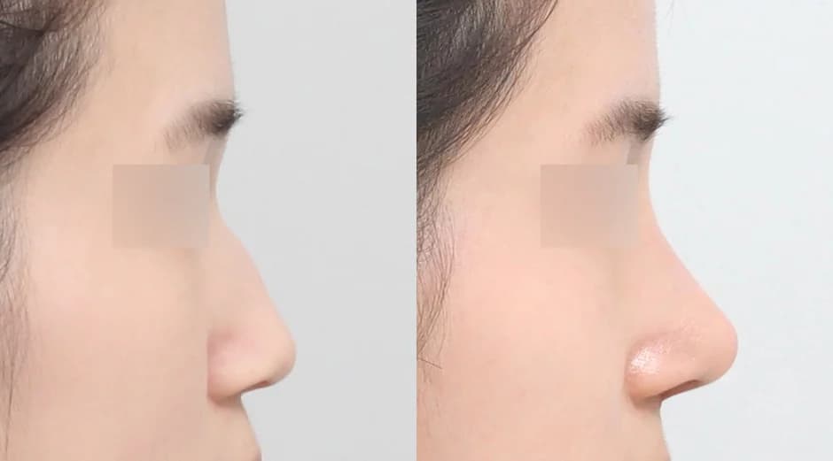 AB Plastic Surgery