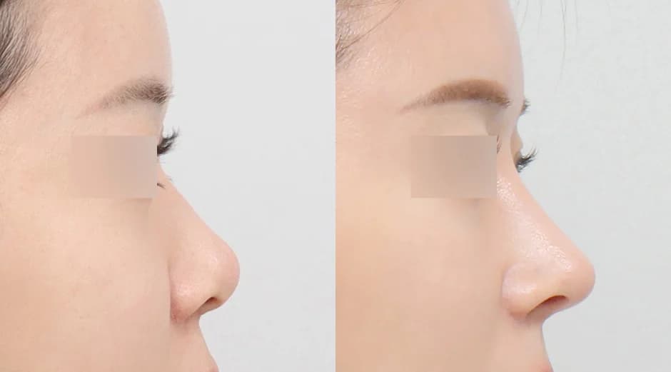 AB Plastic Surgery