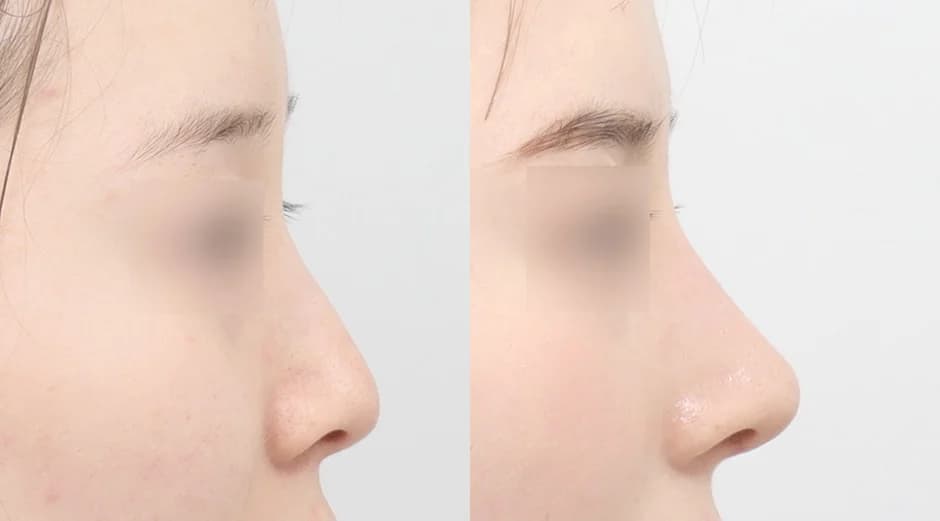 AB Plastic Surgery