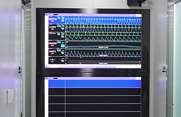 Close Monitoring by a Dedicated Anesthesiologist