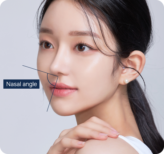 Semi-fancy rhinoplasty nasolabial angle comparison and natural fancy nose design