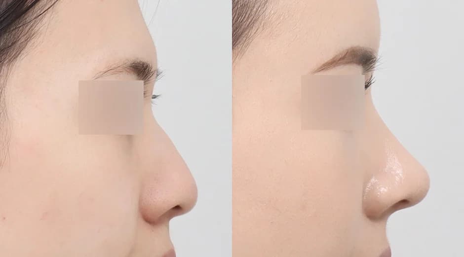 AB Plastic Surgery