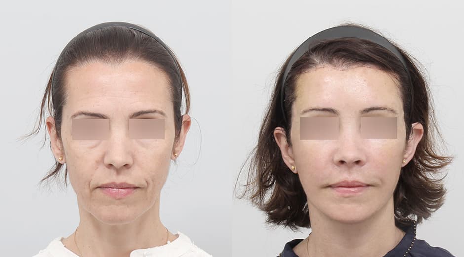 AB Plastic Surgery